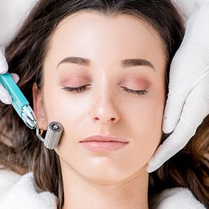 Tratamiento con microagujas Madrid Cyja.com Special Offers, Deals & Discounts in Spain